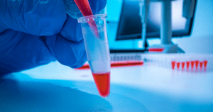 A sample for Bacteria Preservation. Froilabo have a wide range of temperature control equipment for safe Sample Storage.